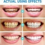 Niacinamide Whitening Toothpaste – Black and solid