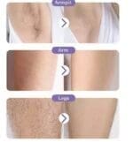 Hair Removal Stone- Black and solid-2